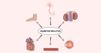 Diabetes mellitus Fettsucht: krank durch zu viel Gewicht