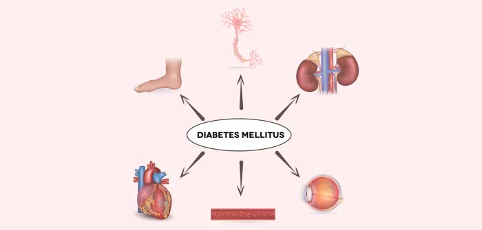 Diabetes mellitus Fettsucht: krank durch zu viel Gewicht